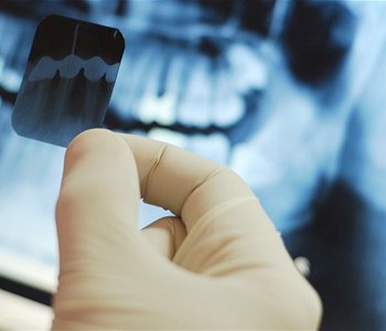 Диагностика - Стоматология в Челябинске | Цены в клинике Стоматологическая здравница