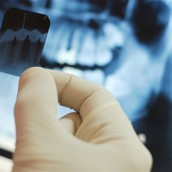 Диагностика - Стоматология в Челябинске | Цены в клинике Стоматологическая здравница